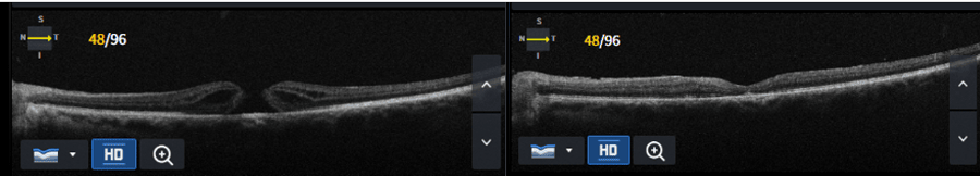 Slider image (10) Dr Nikolaos I Dervenis Eye Clinic